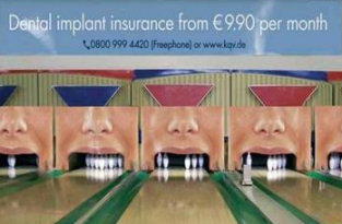 Dental Implants - Advert