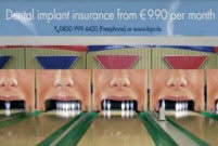 Dental Implants Advert