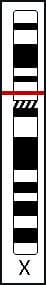 Pedaspheraphobia - Gene for fear of football locus at 100764.776 Xq22.1