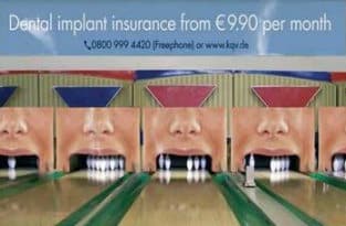 Dental Implants - Advert